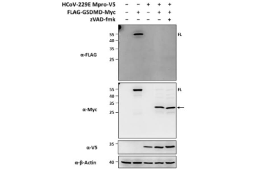 Immunoblot - Anti-V5 Tag Antibody [V5.E10] - Antibodies.com