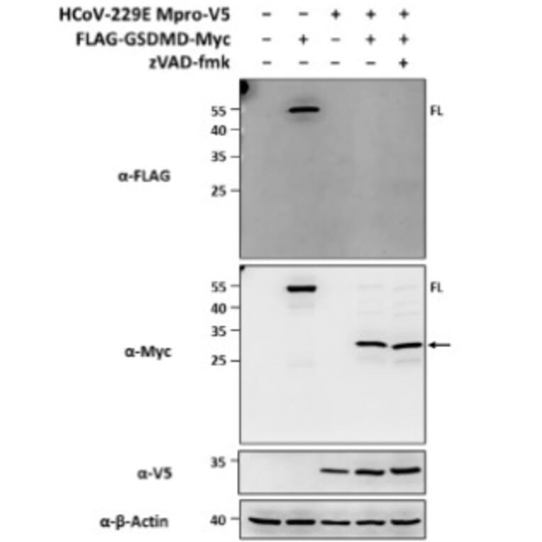 Immunoblot - Anti-V5 Tag Antibody [V5.E10] - Antibodies.com