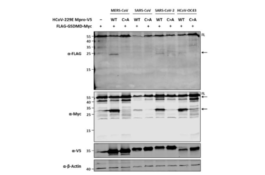 Immunoblot - Anti-V5 Tag Antibody [V5.E10] - Antibodies.com