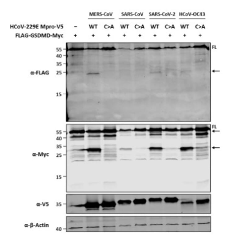 Immunoblot - Anti-V5 Tag Antibody [V5.E10] - Antibodies.com