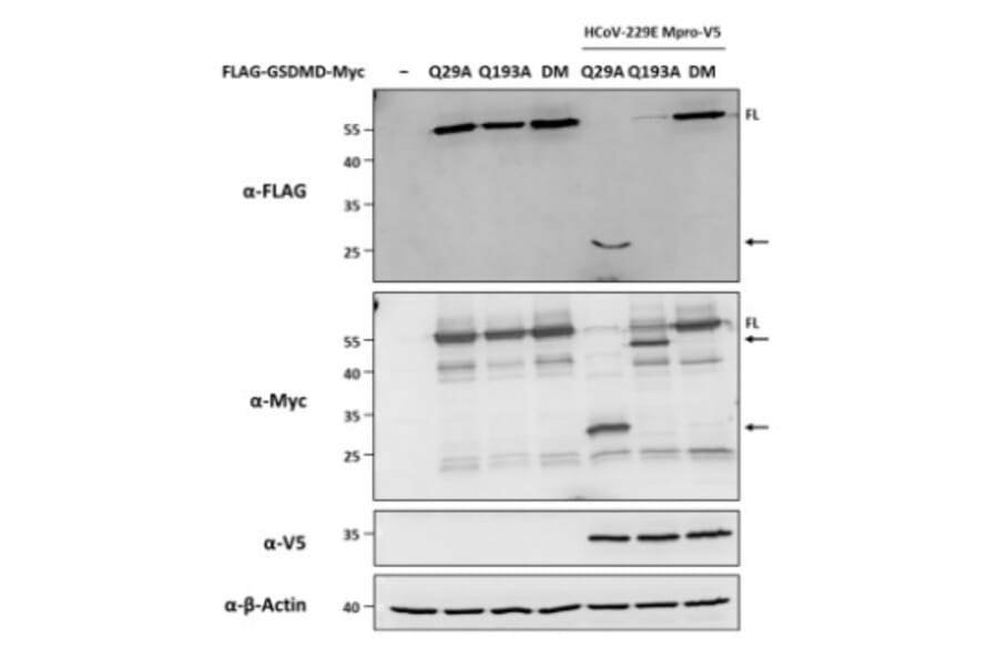 Immunoblot - Anti-V5 Tag Antibody [V5.E10] - Antibodies.com