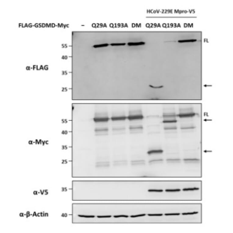 Immunoblot - Anti-V5 Tag Antibody [V5.E10] - Antibodies.com