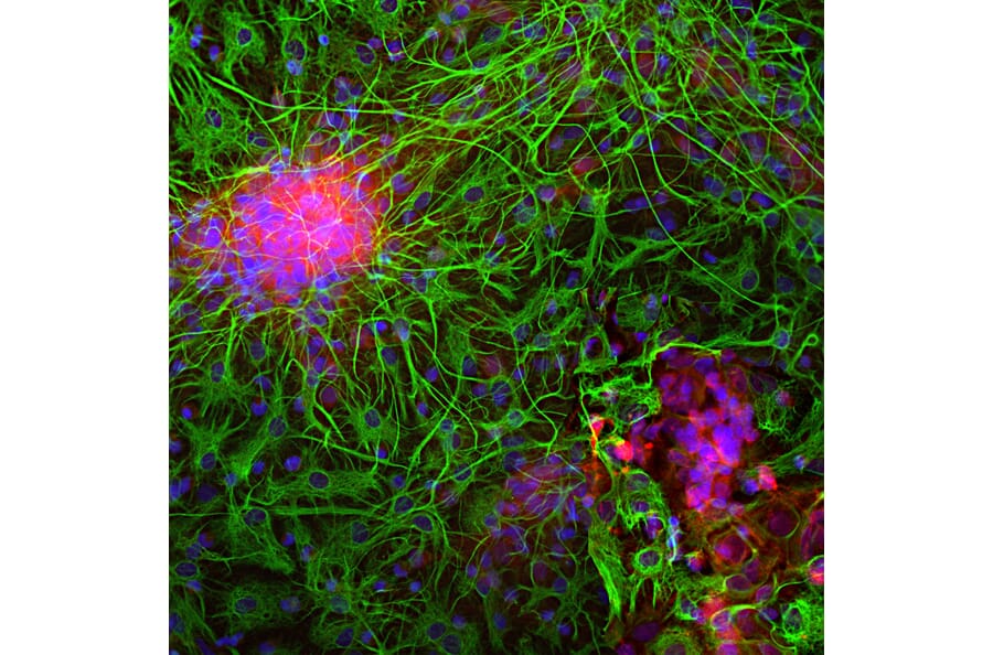 Immunofluorescence - Anti-NSE Antibody (A85285) - Antibodies.com