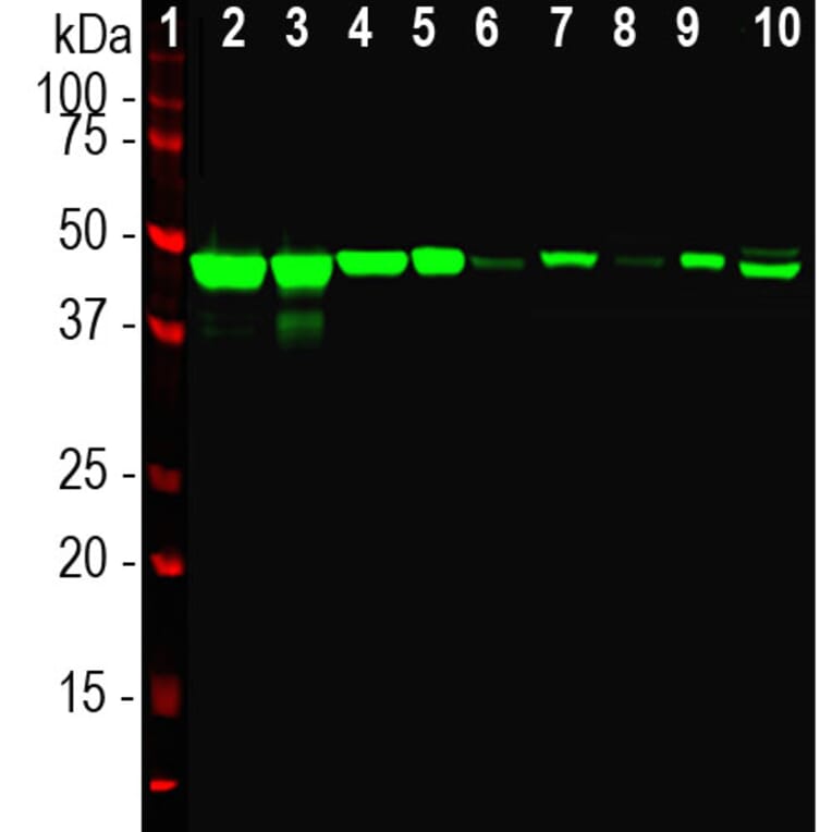 Western Blot - Anti-NSE Antibody (A85285) - Antibodies.com