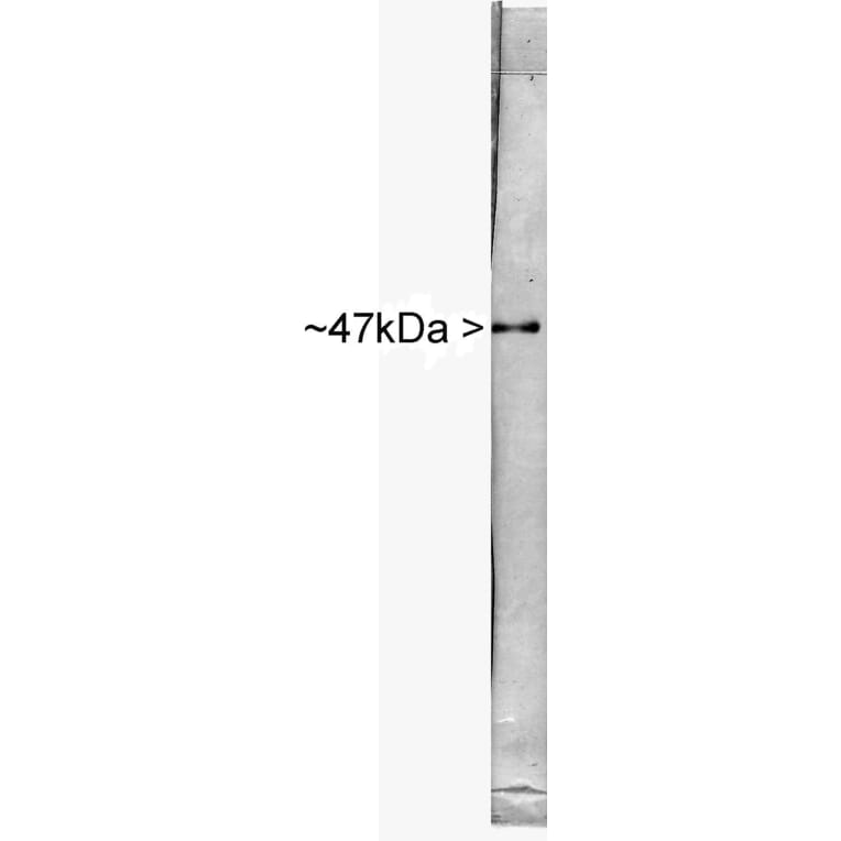 Western Blot - Anti-NSE Antibody (A85285) - Antibodies.com