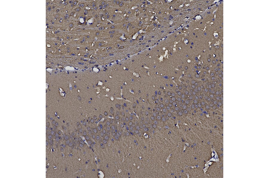 Immunohistochemistry - Anti-NSE Antibody (A85285) - Antibodies.com