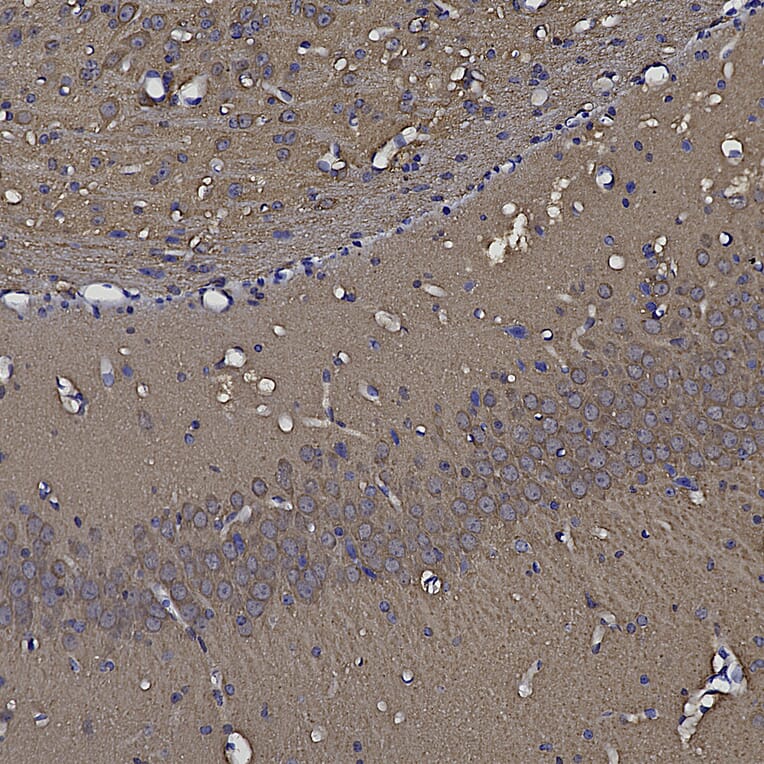 Immunohistochemistry - Anti-NSE Antibody (A85285) - Antibodies.com