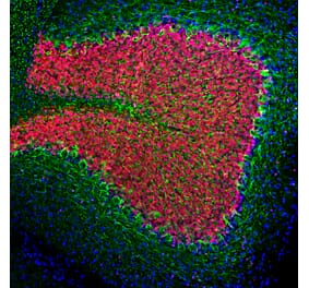 Immunofluorescence - Anti-NF-L Antibody (A85286) - Antibodies.com