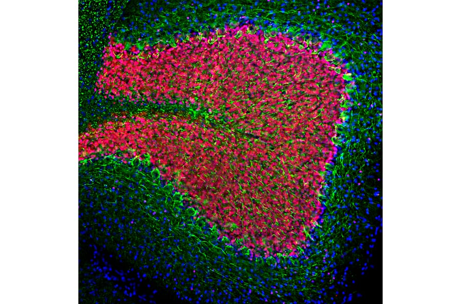 Immunofluorescence - Anti-NF-L Antibody (A85286) - Antibodies.com