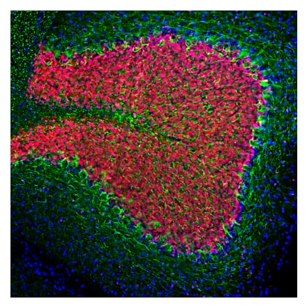 Immunofluorescence - Anti-NF-L Antibody (A85286) - Antibodies.com