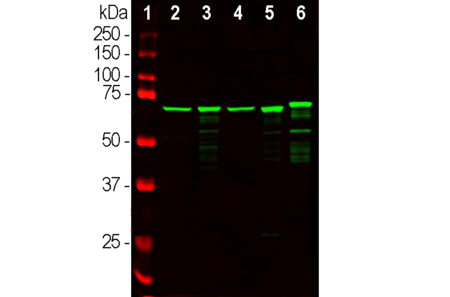 Western Blot - Anti-NF-L Antibody (A85286) - Antibodies.com