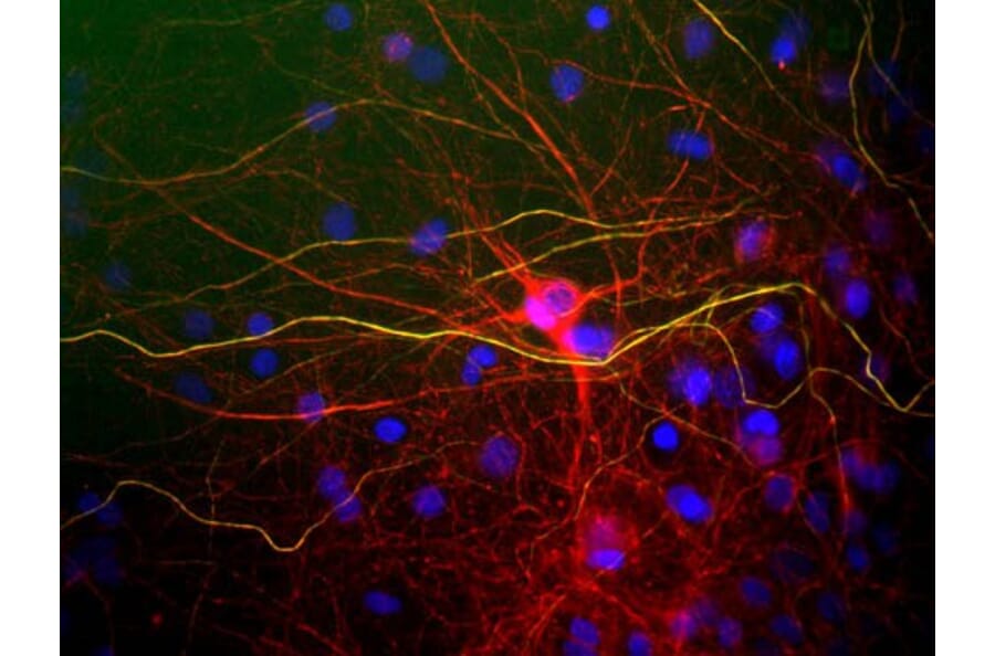 Immunofluorescence - Anti-NF-L Antibody (A85286) - Antibodies.com