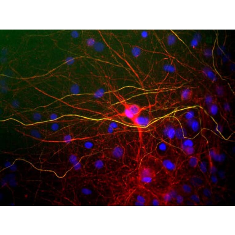 Immunofluorescence - Anti-NF-L Antibody (A85286) - Antibodies.com