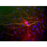 Immunofluorescence - Anti-NF-L Antibody (A85286) - Antibodies.com