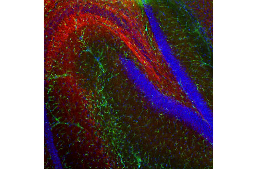 Immunofluorescence - Anti-NF-L Antibody (A85286) - Antibodies.com