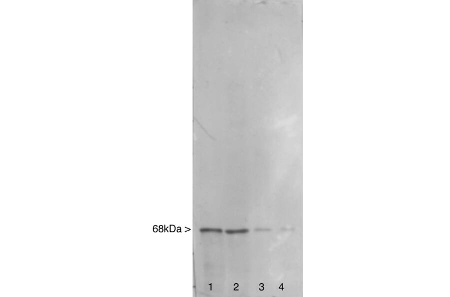 Western Blot - Anti-NF-L Antibody (A85286) - Antibodies.com