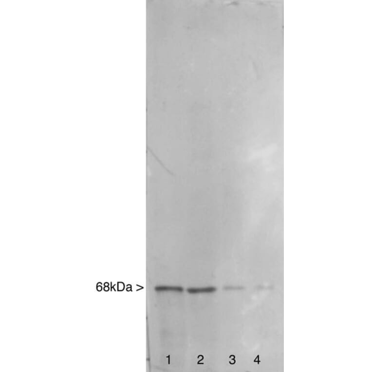 Western Blot - Anti-NF-L Antibody (A85286) - Antibodies.com