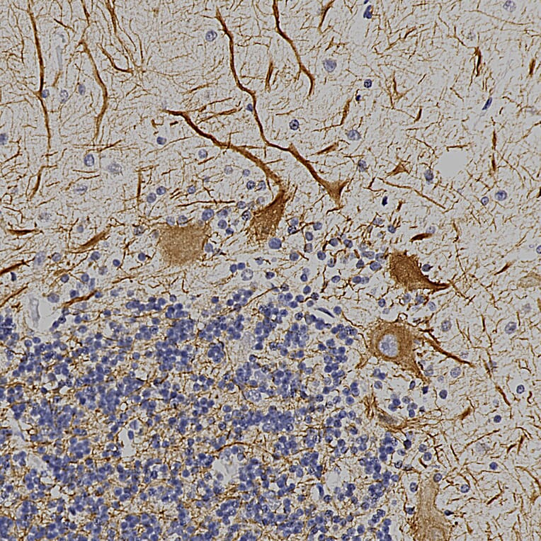 Immunohistochemistry - Anti-NF-L Antibody (A85286) - Antibodies.com