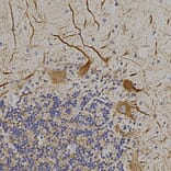 Immunohistochemistry - Anti-NF-L Antibody (A85286) - Antibodies.com