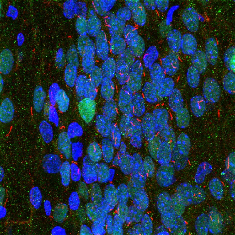 Immunofluorescence - Anti-Adenylate Cyclase 3 Antibody (A85287) - Antibodies.com