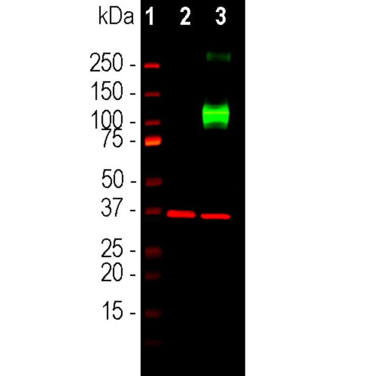 Western Blot - Anti-Adenylate Cyclase 3 Antibody (A85287) - Antibodies.com