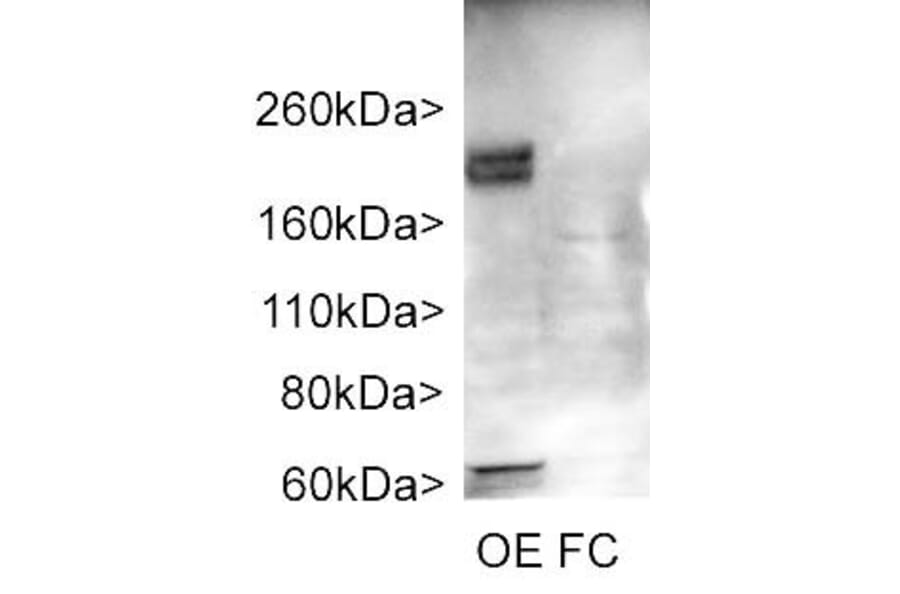 Western Blot - Anti-Adenylate Cyclase 3 Antibody (A85287) - Antibodies.com