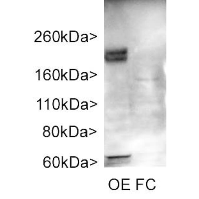 Western Blot - Anti-Adenylate Cyclase 3 Antibody (A85287) - Antibodies.com