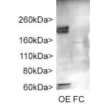 Western Blot - Anti-Adenylate Cyclase 3 Antibody (A85287) - Antibodies.com