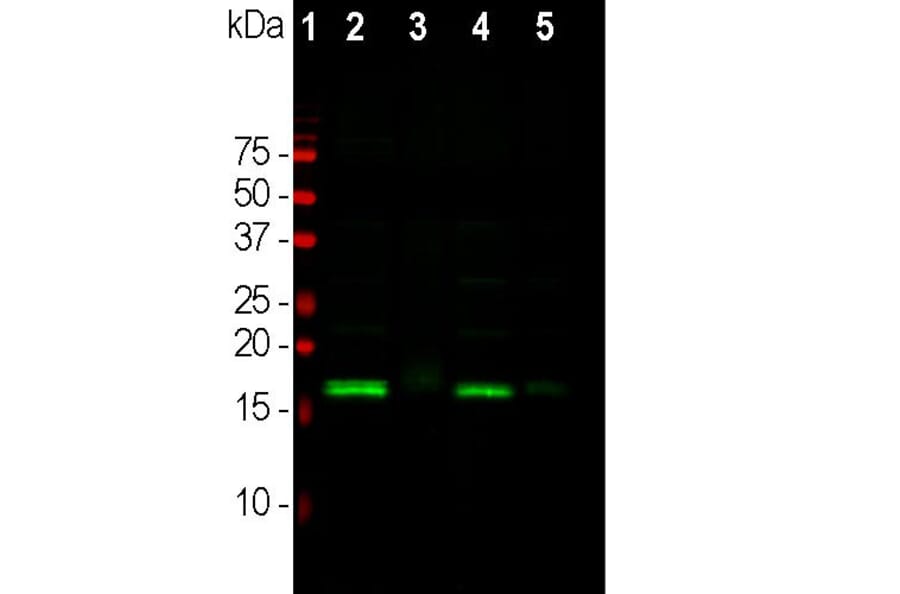 Western Blot - Anti-alpha Synuclein Antibody (A85289) - Antibodies.com