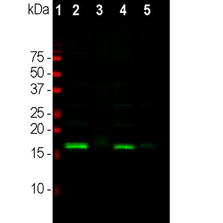 Western Blot - Anti-alpha Synuclein Antibody (A85289) - Antibodies.com