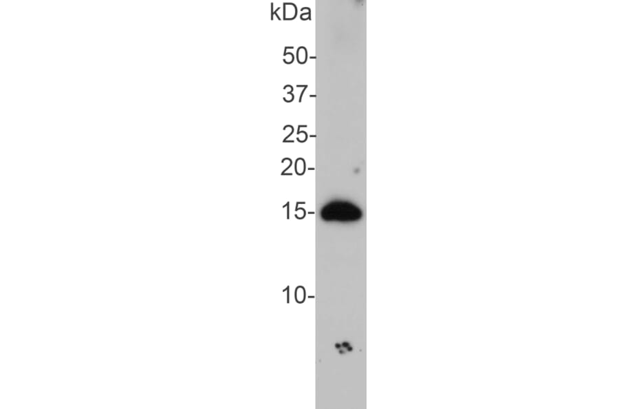 Western Blot - Anti-alpha Synuclein Antibody (A85289) - Antibodies.com