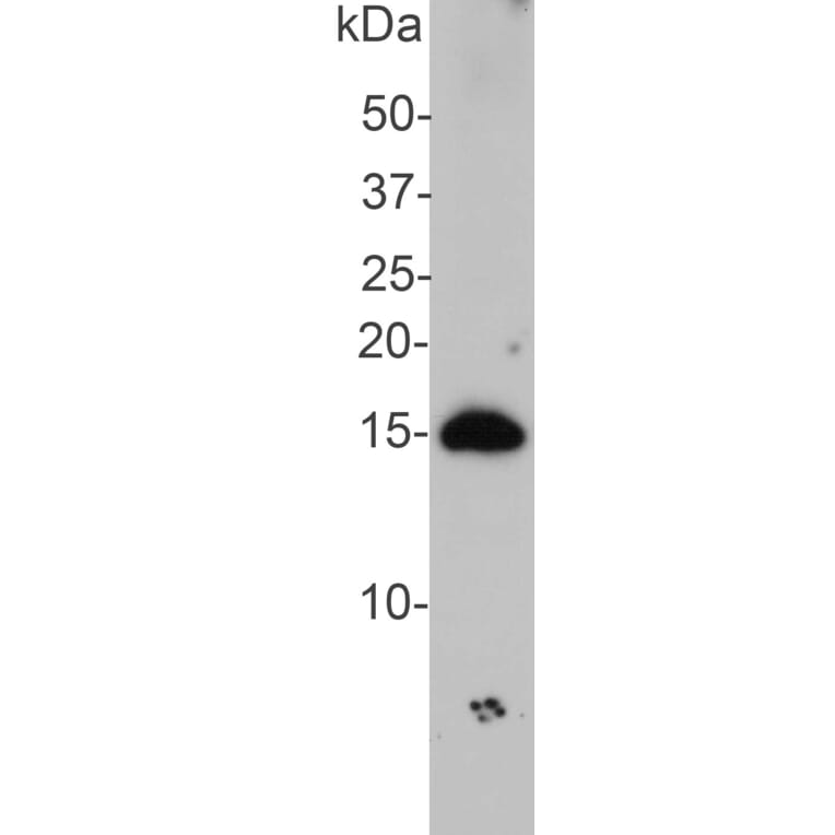 Western Blot - Anti-alpha Synuclein Antibody (A85289) - Antibodies.com