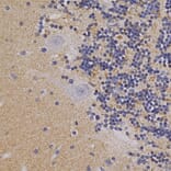 Immunohistochemistry - Anti-alpha Synuclein Antibody (A85289) - Antibodies.com