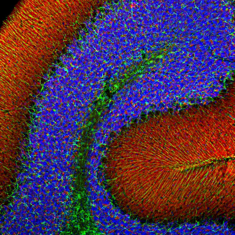 Immunofluorescence - Anti-a-Synuclein Antibody (A85290) - Antibodies.com