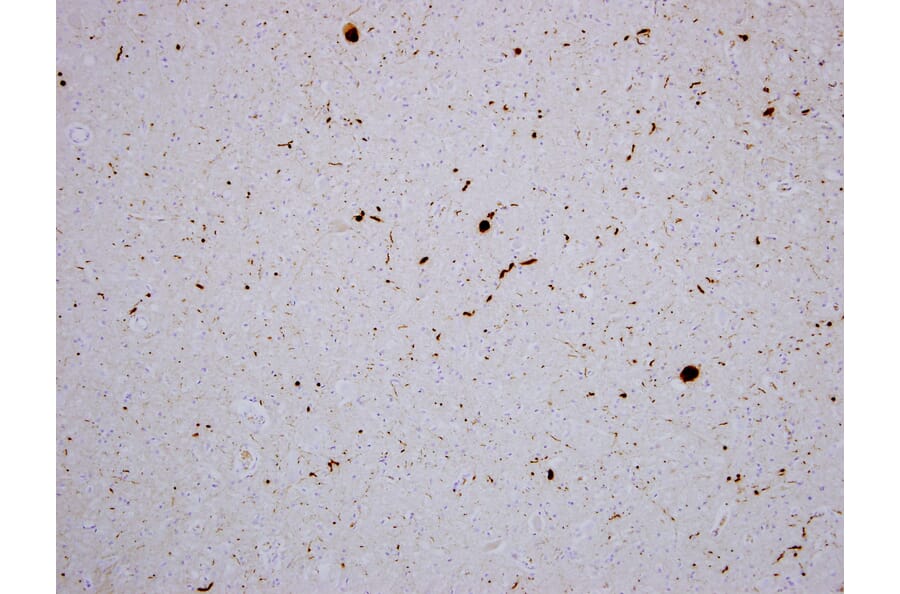 Immunohistochemistry - Anti-alpha Synuclein Antibody [2A7] (A85290) - Antibodies.com