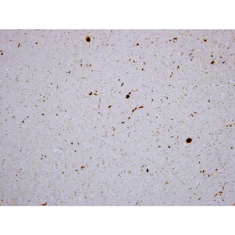 Immunohistochemistry - Anti-alpha Synuclein Antibody [2A7] (A85290) - Antibodies.com