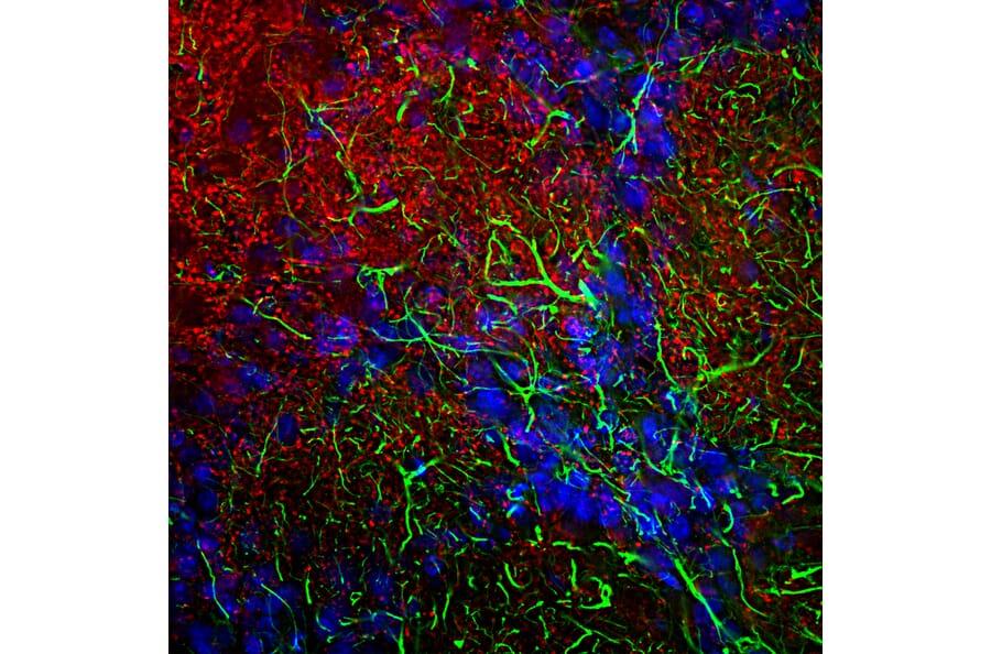 Immunofluorescence - Anti-alpha Synuclein Antibody [2A7] (A85290) - Antibodies.com