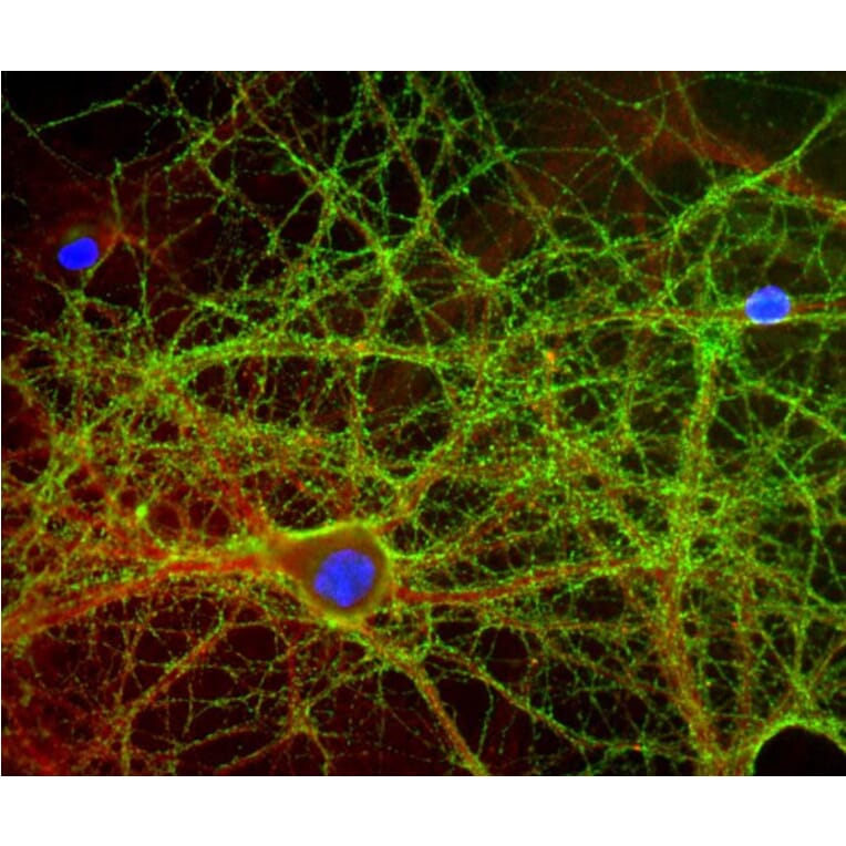 Immunofluorescence - Anti-GAP43 Antibody (A85292) - Antibodies.com