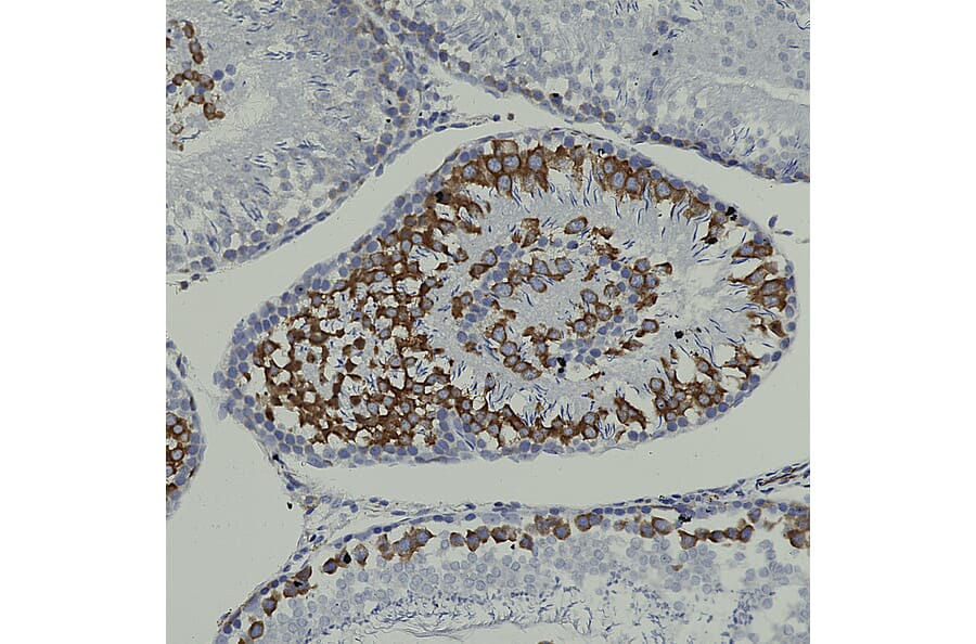 Immunohistochemistry - Anti-Nestin Antibody [4D11] (A85293) - Antibodies.com