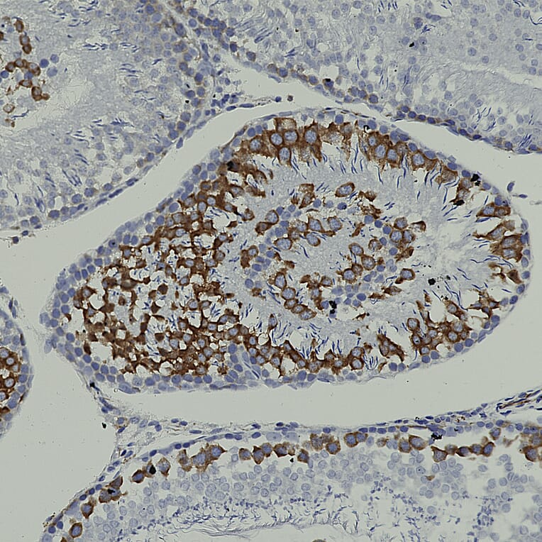 Immunohistochemistry - Anti-Nestin Antibody [4D11] (A85293) - Antibodies.com