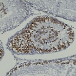 Immunohistochemistry - Anti-Nestin Antibody [4D11] (A85293) - Antibodies.com