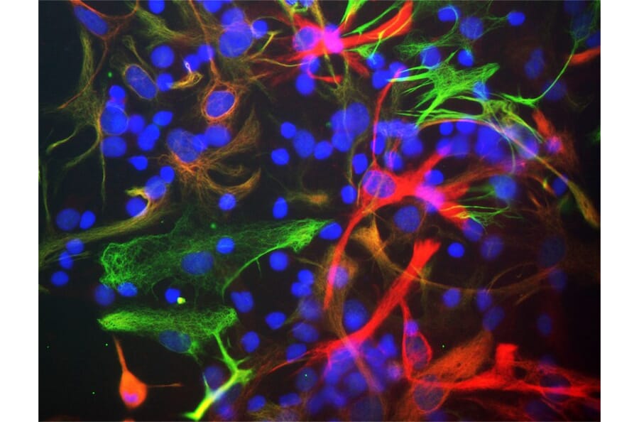 Immunofluorescence - Anti-Nestin Antibody [4D11] (A85293) - Antibodies.com