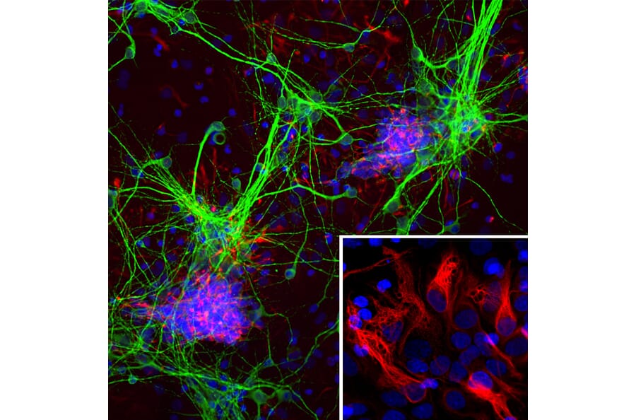 Immunofluorescence - Anti-Nestin Antibody [4D11] (A85293) - Antibodies.com