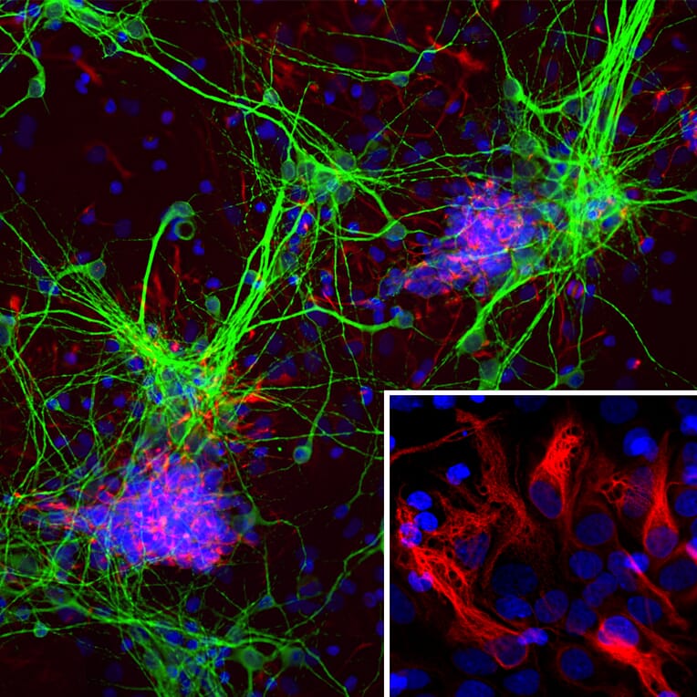 Immunofluorescence - Anti-Nestin Antibody [4D11] (A85293) - Antibodies.com