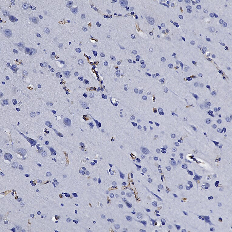 Immunohistochemistry - Anti-Nestin Antibody (A85294) - Antibodies.com