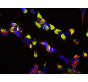 Immunofluorescence - Anti-Nestin Antibody (A85294) - Antibodies.com