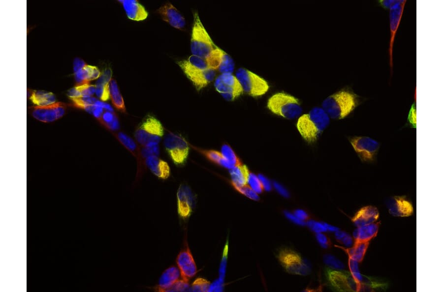 Anti-Nestin Antibody (A85294) IHC