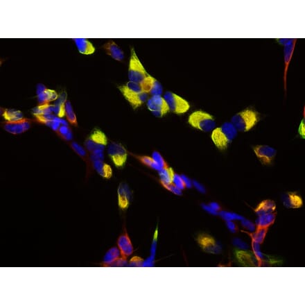 Immunofluorescence - Anti-Nestin Antibody (A85294) - Antibodies.com