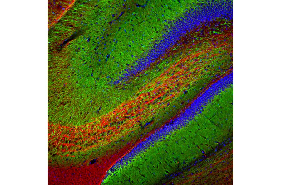 Immunofluorescence - Anti-MAP2 Antibody [5H11] (A85296) - Antibodies.com