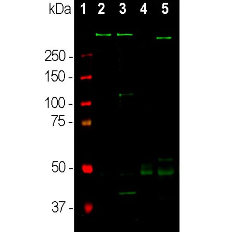 Western Blot - Anti-MAP2 Antibody [5H11] (A85296) - Antibodies.com
